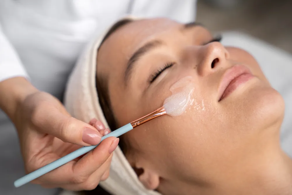 How Chemical Peels Help in Reducing Acne Scars
