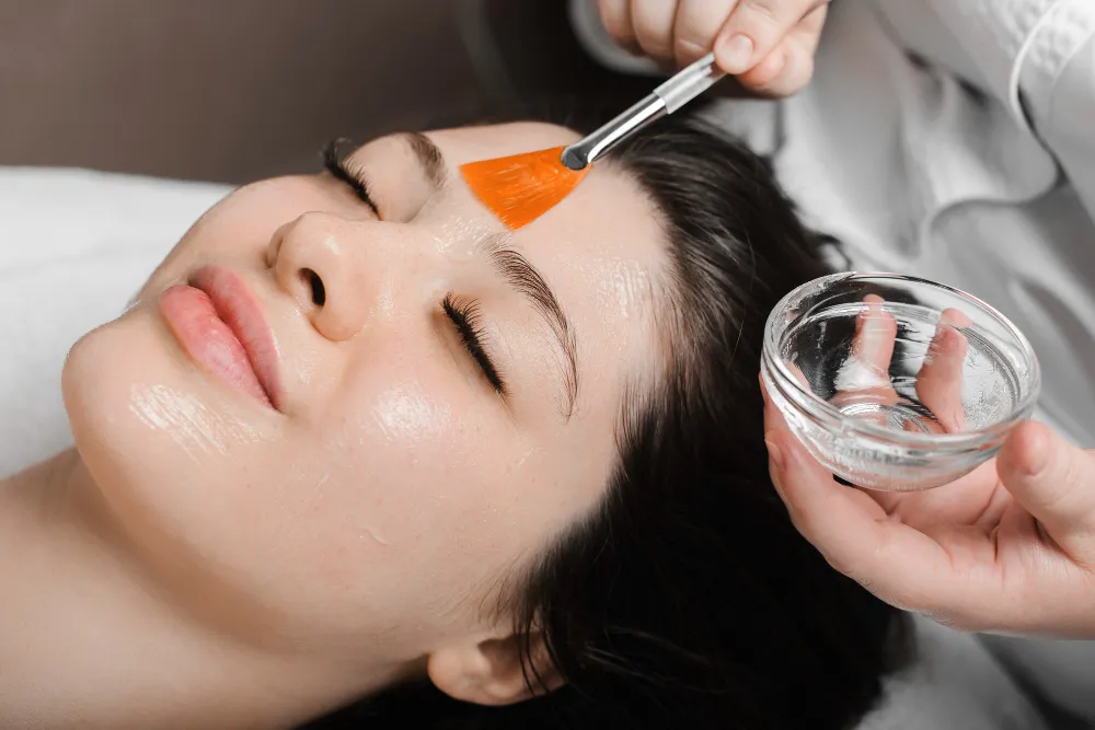 Best Age to Start Chemical Peels for Anti-Aging
