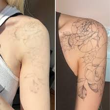 How many weeks between Pico Laser tattoo removal sessions?